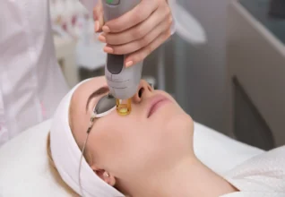 Vascular Lesions Treatment at First Ave Medical Spa In Vancouver