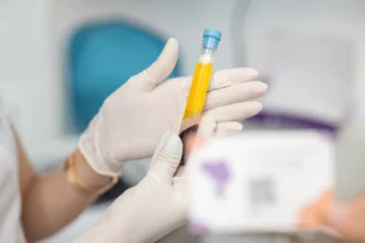 PRP with Morpheus8 First Ave Medical spa