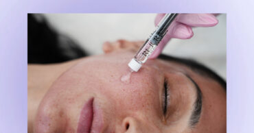 Laser Rejuvenation with Salmon DNA Skin Boosters