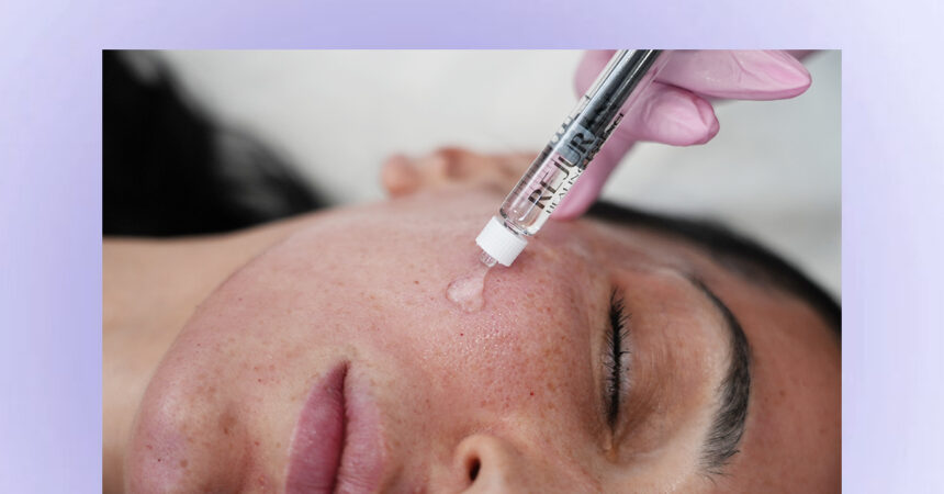 Laser Rejuvenation with Salmon DNA Skin Boosters