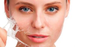 Chemical Peel at First Ave Medical Spa In Vancouver