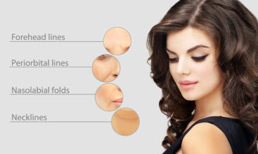 Botox Vancouver: Neuromodulators for Natural Wrinkle Reduction