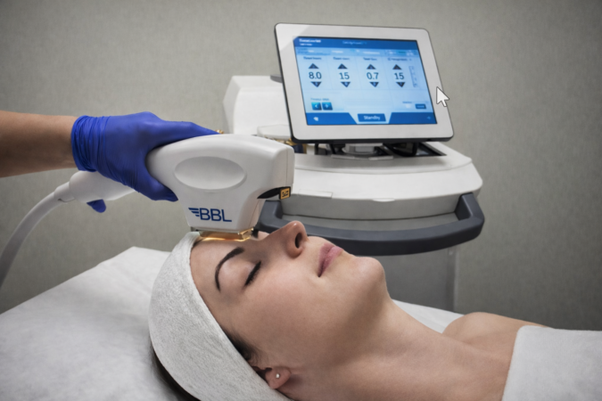 BBL Hero Treatment Vancouver First Ave Medical Spa