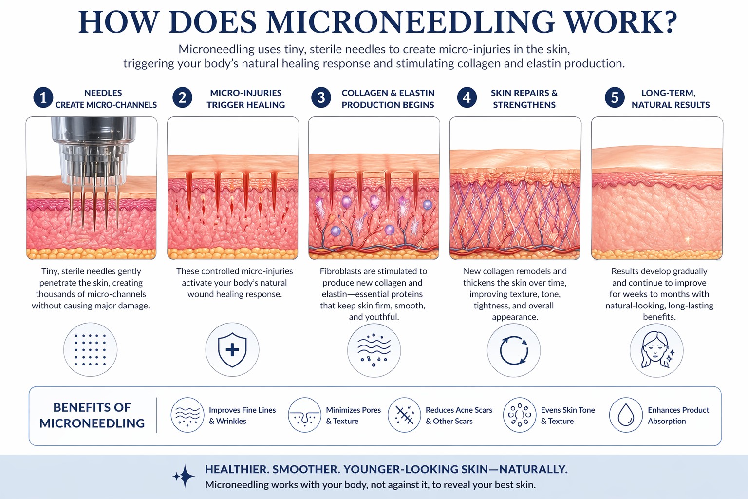 How Does Microneedling Work?