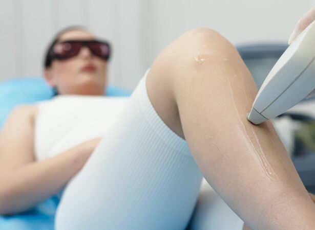 How Many Laser Hair Removal Sessions