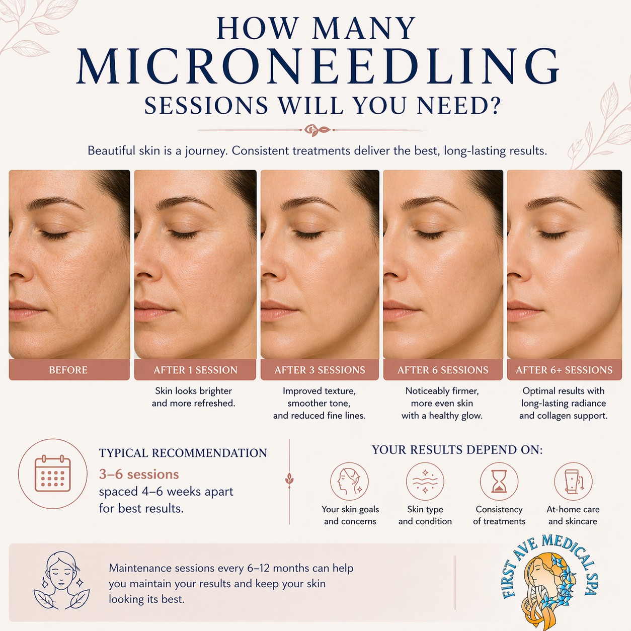 How Many Microneedling Sessions Will You Need?