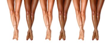 Laser Hair Removal for Dark Skin