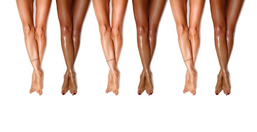 Laser Hair Removal for Dark Skin