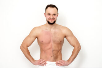 Laser Hair Removal vs Waxing Vancouver