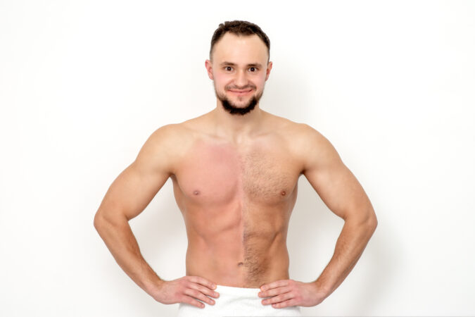 Laser Hair Removal vs Waxing Vancouver