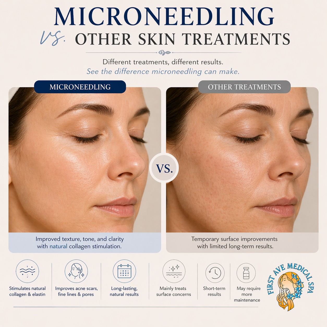 Microneedling vs. Other Skin Treatments