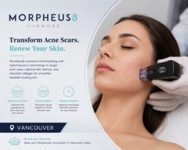 Morpheus8 Acne Scars Vancouver