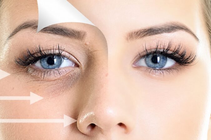 First What Is Actually Causing Your Under Eye Concern