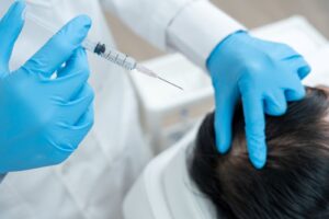 PRP hair loss appointment for women at our Kitsilano clinic