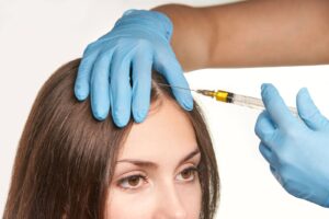 PRP scalp treatment for female hair thinning in Vancouver, BC