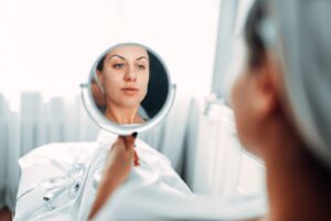 natural filler results at a follow up visit in Kitsilano, Vancouver