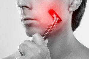 razor irritation on the jawline, a reason men in Vancouver choose laser hair removal fista ave medical spa 